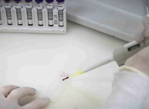 secretaria-de-saude-de-sp-investiga-novo-caso-suspeito-de-ebola